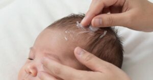 Coconut Oil for Newborn Hair