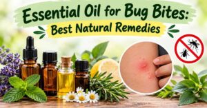 Essential oil for bug bites